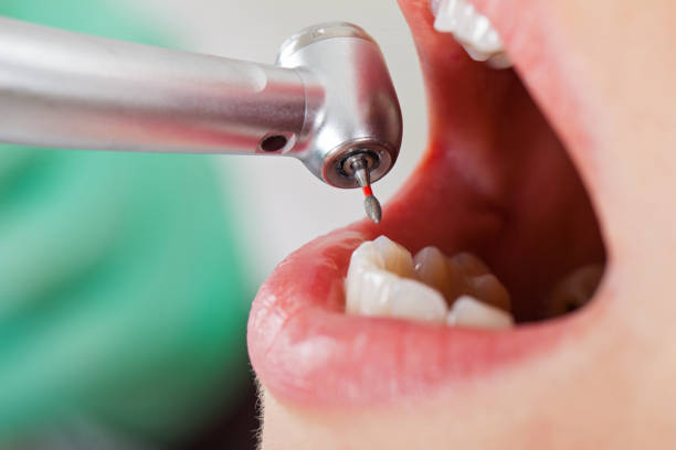 Best Walk-In Emergency Dentist in New Tazewell, TN